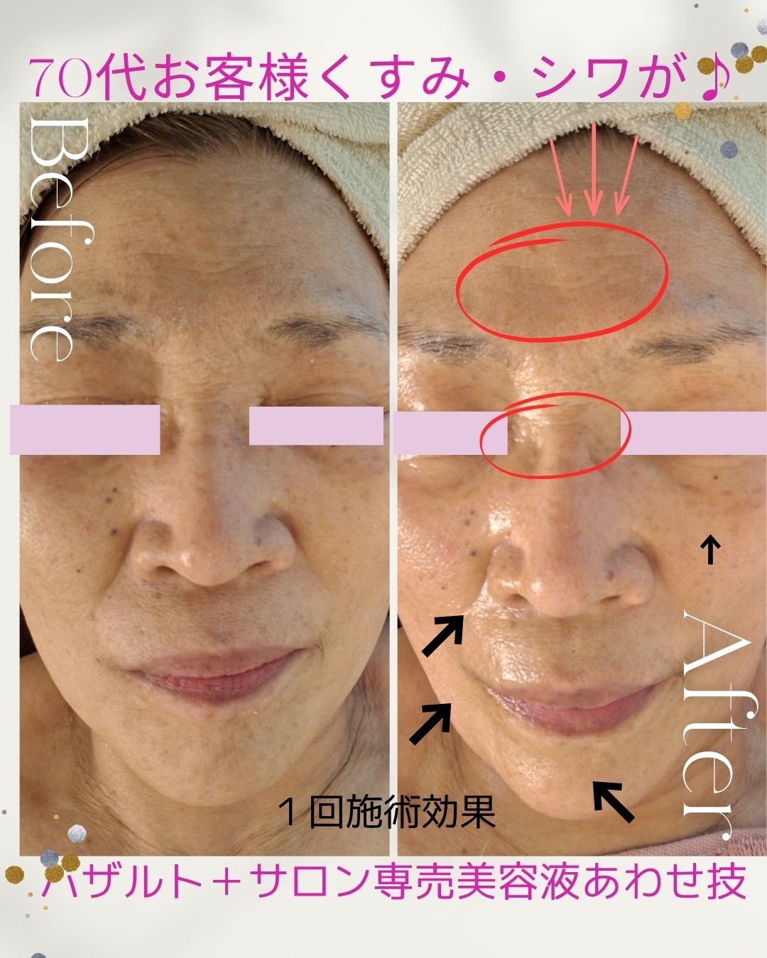 【たった１回でもこの効果！70代女性の素敵なサロンの使い方】
